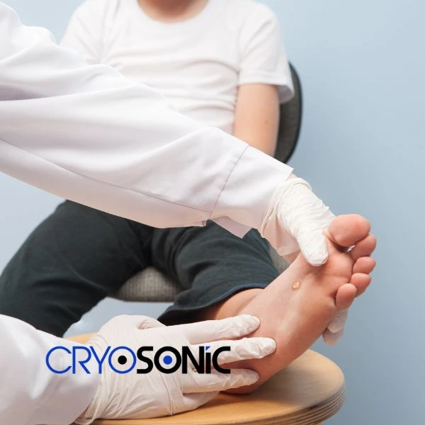 Are you looking for fast effective wart removal Contact us today Worksop